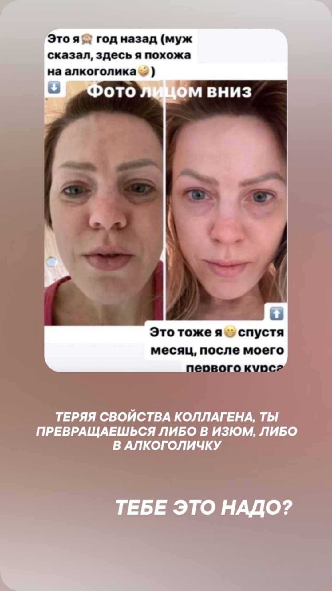 Девочки, успевайте на популярный коллаген (1)