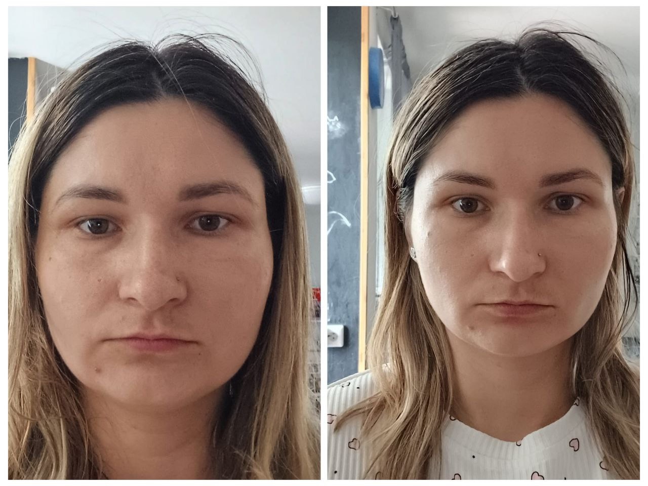 ### Идеальное решение от летних (3)