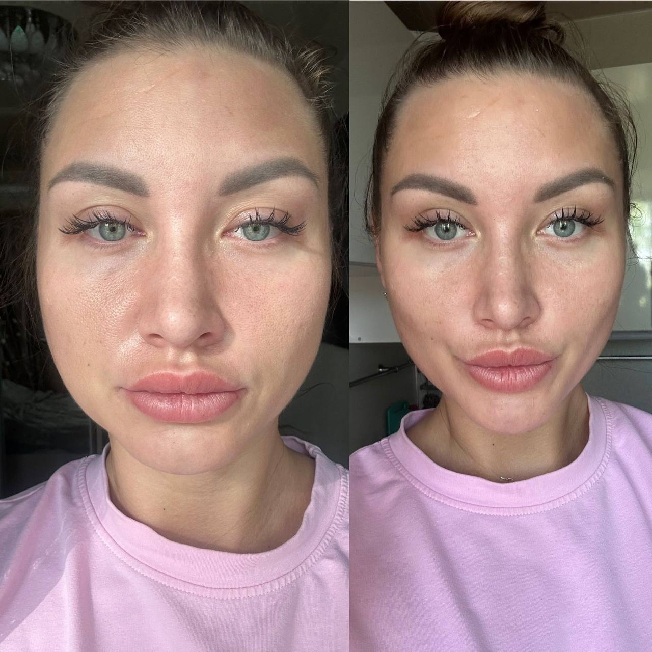 ### Идеальное решение от летних (4)