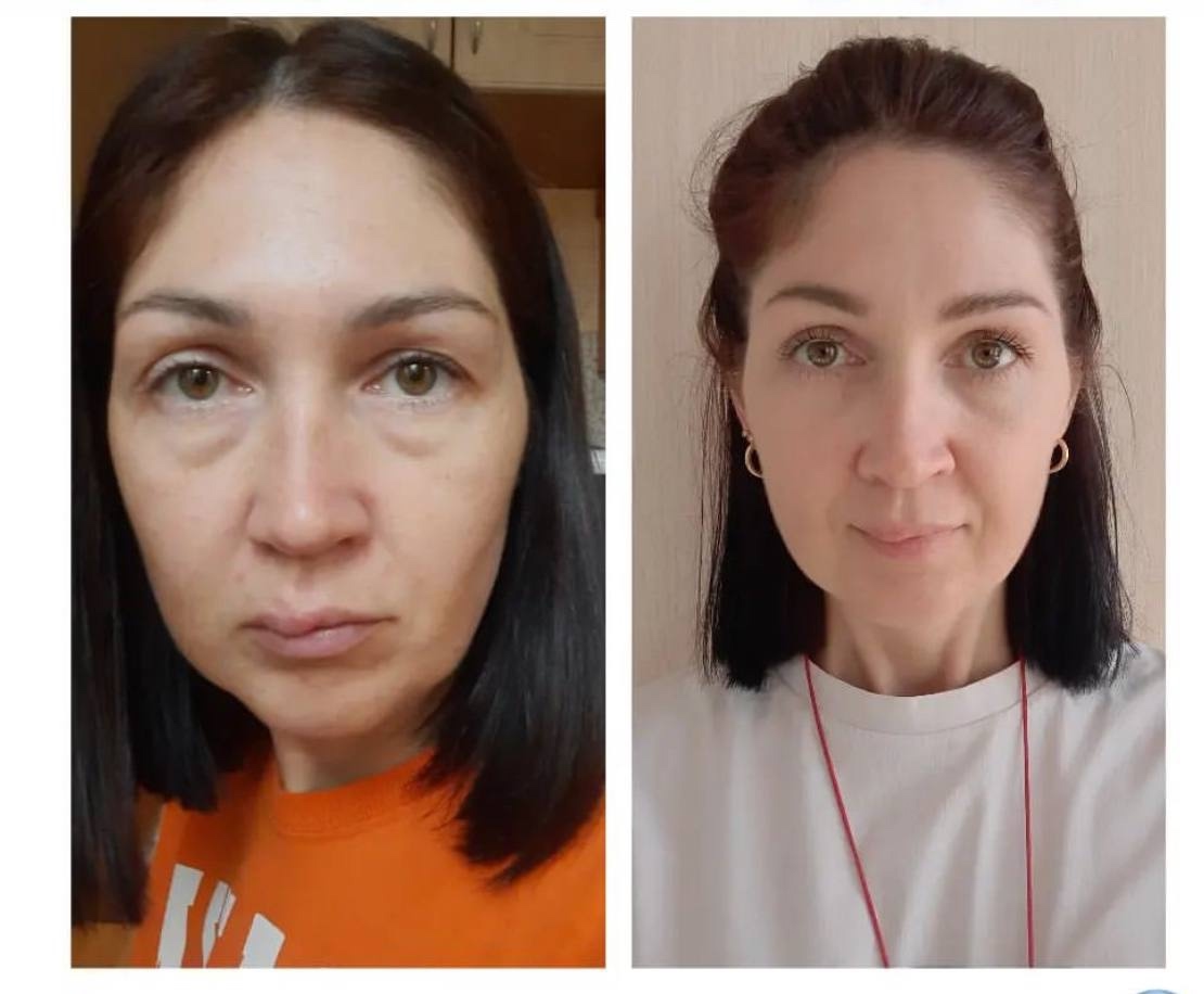 ### Идеальное решение от летних (2)