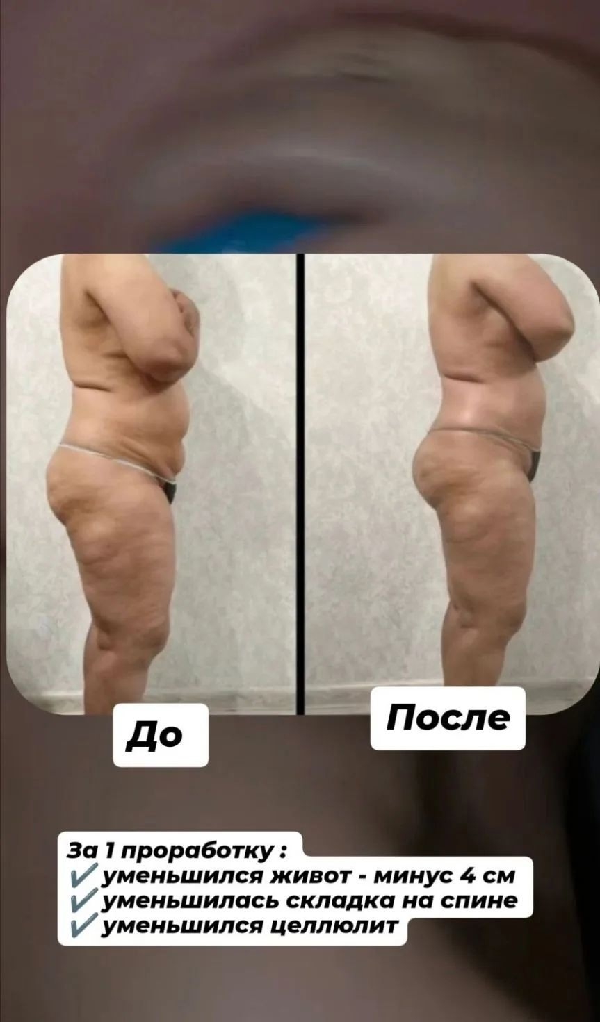 Мастер ручной коррекции фигуры предлагает (2)