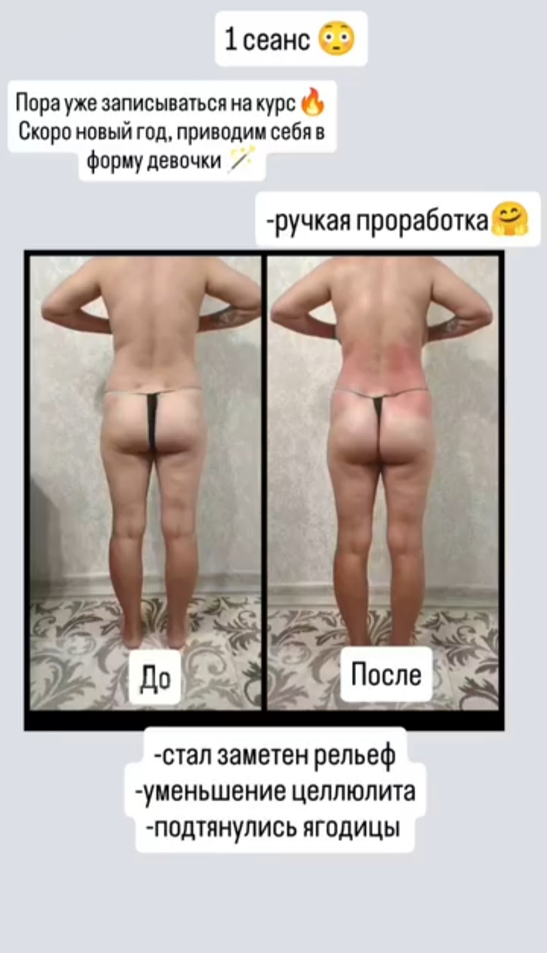 Мастер ручной коррекции фигуры предлагает